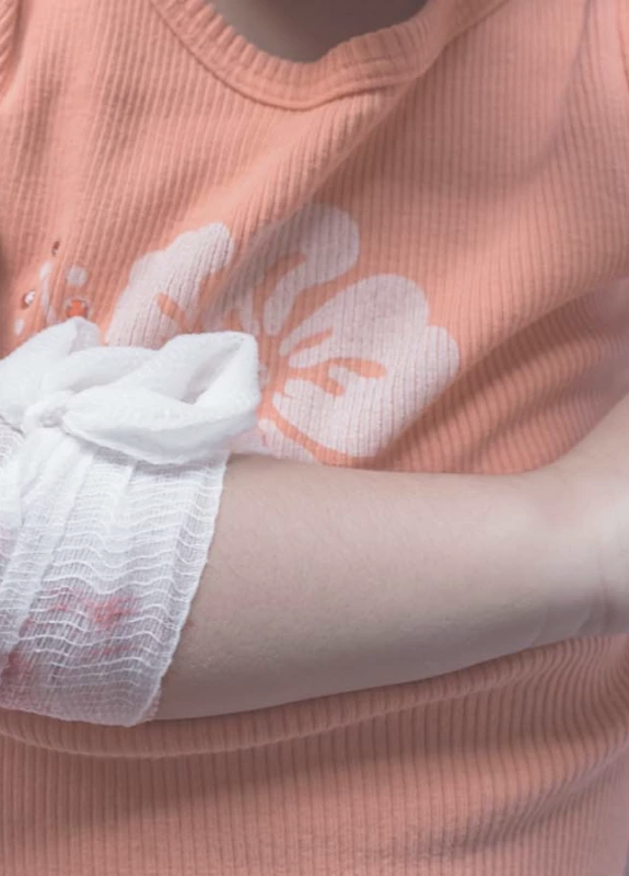 personal injury for a minor 